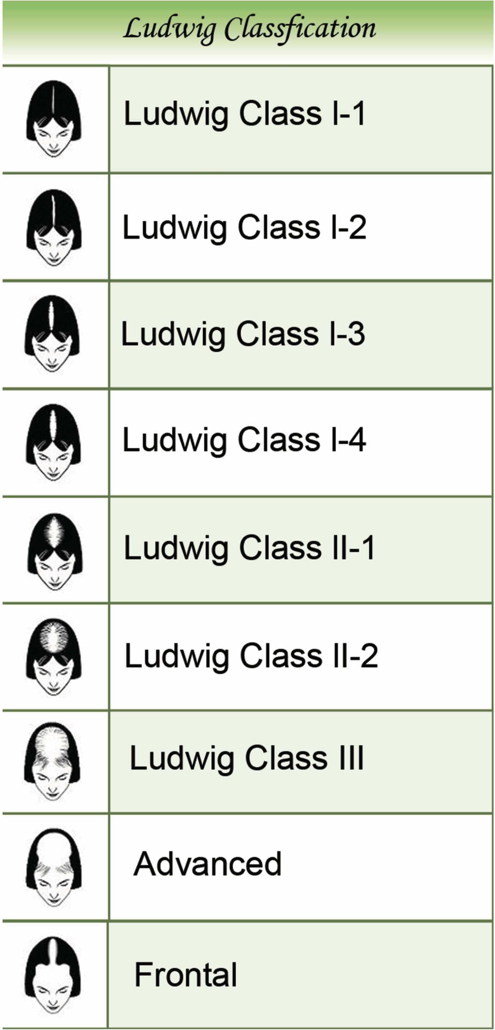 LUDWIG